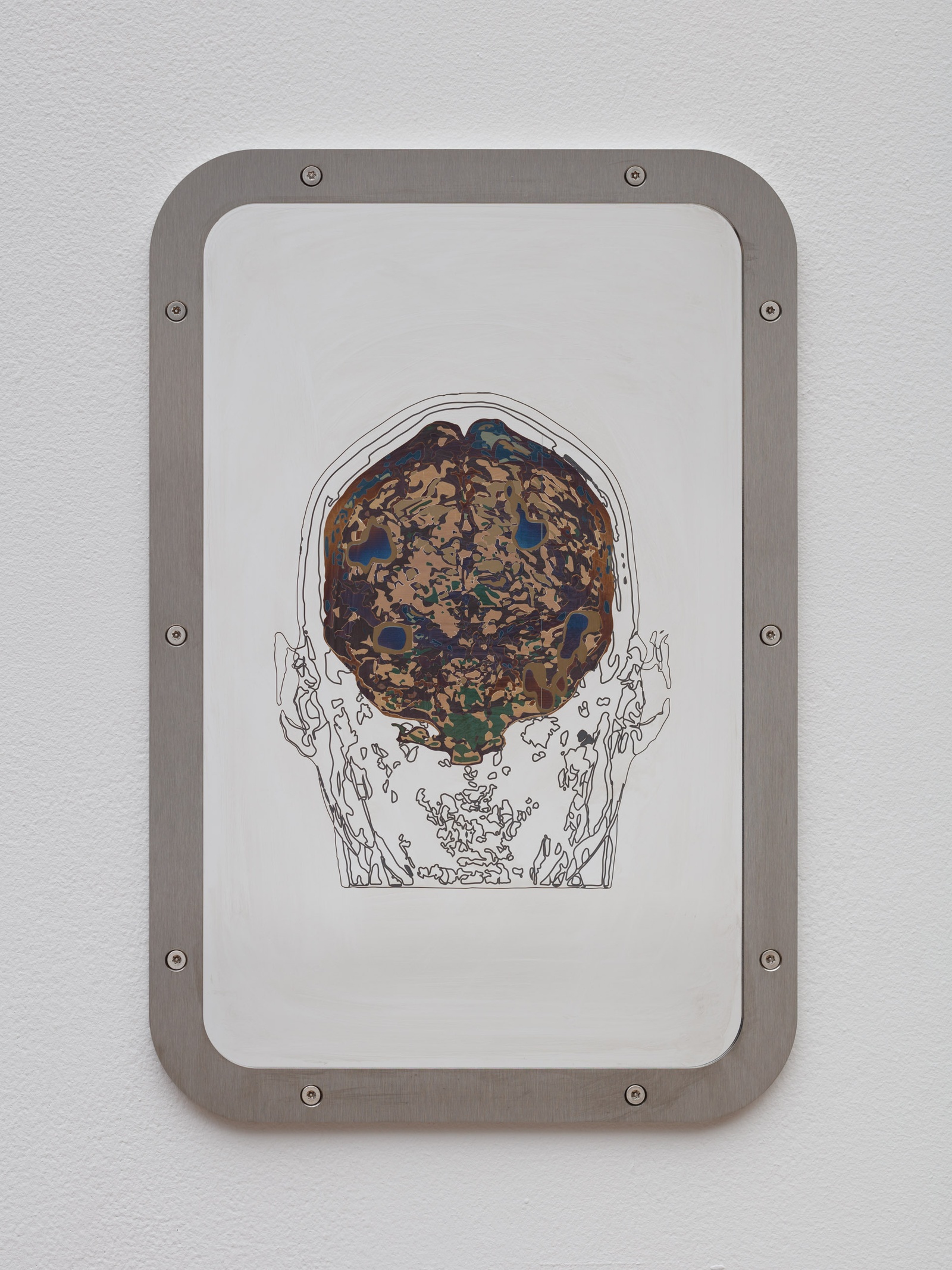 Exposure to Havana Syndrome (MRI/back), Self-Portrait, 2020laser engraving on stainless steel prison mirror45 x 30 cm | 17 3/4 x 11 3/4 in
