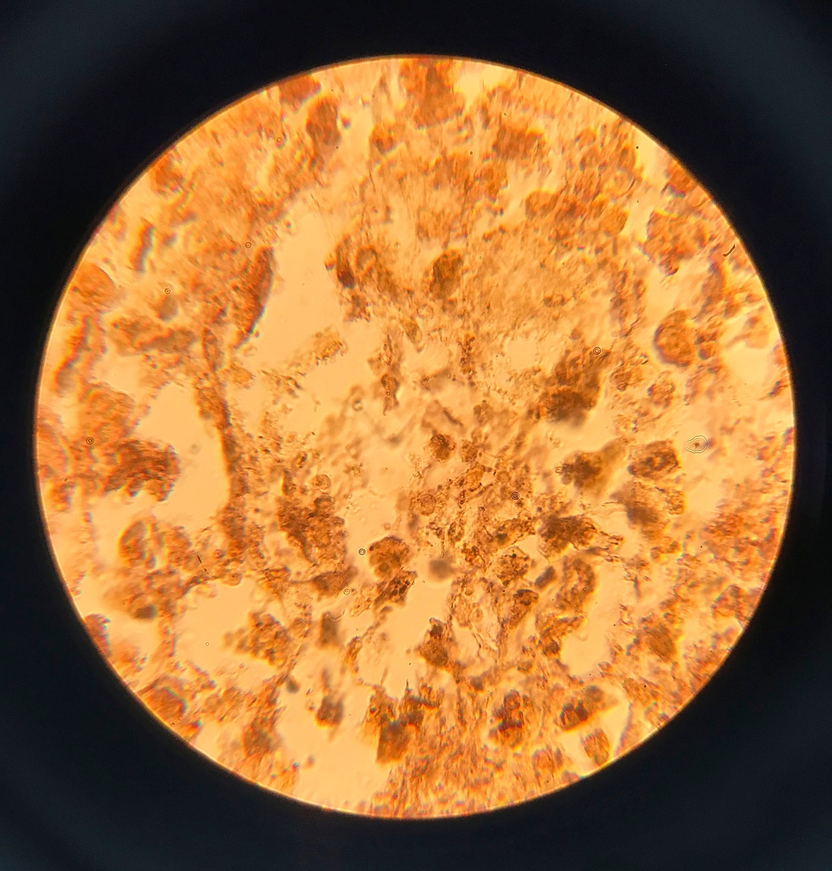 Puppies Puppies (Jade Guanaro Kuriki-Olivo). Treponema pallidum (Syphilis), 2018. glass, treponema pallidum, Bresser Erudite microscope. 32 x 20 x 10 cm