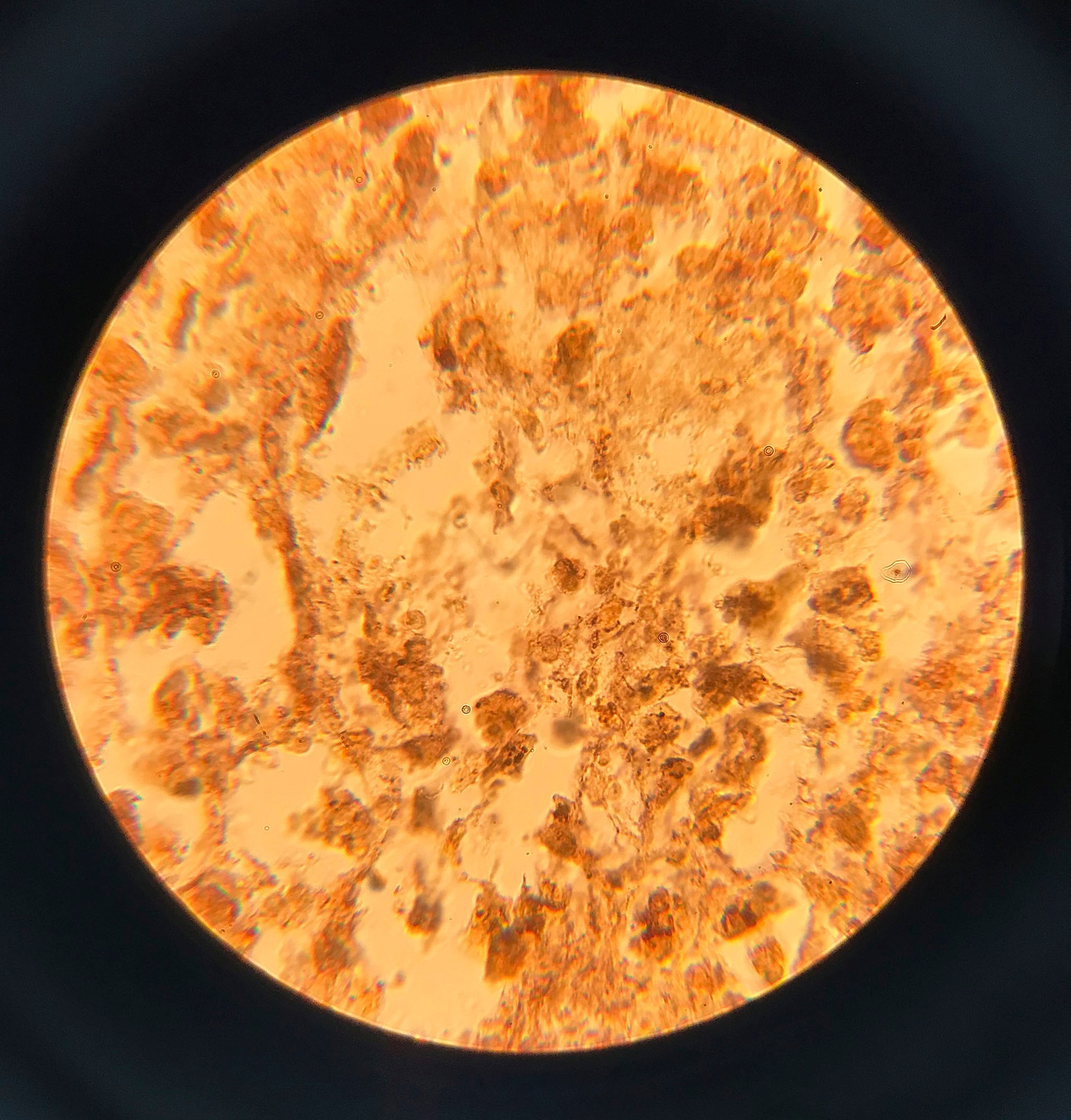 Puppies Puppies (Jade Guanaro Kuriki-Olivo). Treponema pallidum (Syphilis), 2018. glass, treponema pallidum, Bresser Erudite microscope. 32 x 20 x 10 cm